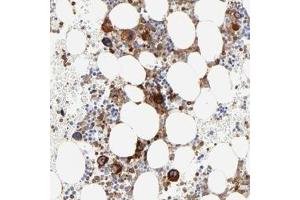 Immunohistochemical staining of human bone marrow with FLNA polyclonal antibody  shows strong cytoplasmic positivity in bone marrow poietic cells at 1:200-1:500 dilution. (Filamin A 抗体)