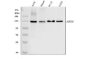Western blot analysis of TMEM16A using anti-TMEM16A antibody (ABIN6719430). (ANO1 抗体)