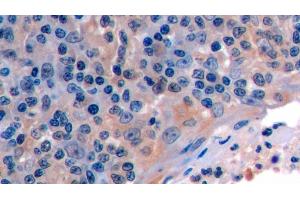 Detection of FAS in Human Tonsil Tissue using Polyclonal Antibody to Factor Related Apoptosis (FAS) (FAS 抗体  (AA 22-172))