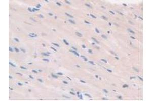 IHC-P analysis of Mouse Heart Tissue, with DAB staining. (CARD9 抗体  (AA 274-530))