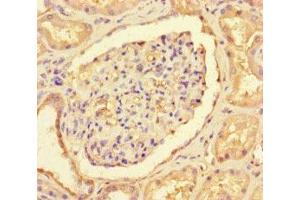Immunohistochemistry of paraffin-embedded human kidney tissue using ABIN7147089 at dilution of 1:100 (CNOT1 抗体  (AA 604-867))