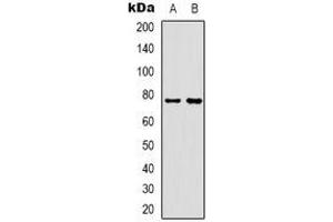 Western blot analysis of Rabphilin 3A expression in Hela (A), mouse muscle (B) whole cell lysates. (RPH3A 抗体)