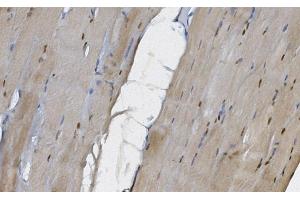 IHC analysis of MEK5/MAP2K5 using anti-MEK5/MAP2K5 antibody (ABIN7602630). (MAP2K5 抗体  (AA 9-442))