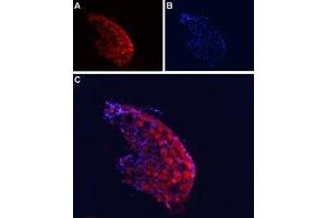 Immunohistochemistry (IHC) image for anti-Calcium Channel, Voltage-Dependent, alpha 2/delta Subunit 4 (CACNA2D4) (AA 881-896), (Extracellular) antibody (ABIN7043016)