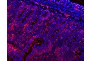 IF analysis of VAPA using anti-VAPA antibody (ABIN7603249). (VAPA 抗体  (N-Term))