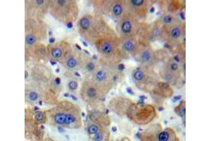 Used in DAB staining on fromalin fixed paraffin-embedded Liver tissue (ACTC1 抗体  (AA 156-368))
