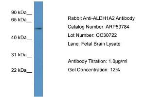 WB Suggested Anti-ALDH1A2  Antibody Titration: 0. (ALDH1A2 抗体  (N-Term))