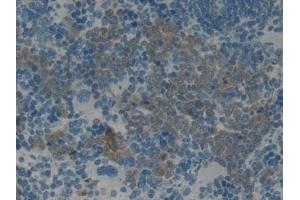 Detection of PAI2 in Rat Spleen Tissue using Monoclonal Antibody to Plasminogen Activator Inhibitor 2 (PAI2) (SERPINB2 抗体  (AA 154-408))