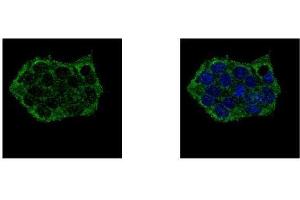 ICC/IF Image EPB41L3 antibody [C3], C-term detects EPB41L3 protein at cytoplasm by confocal immunofluorescent analysis. (EPB41L3 抗体  (C-Term))