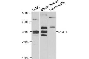 Western blot analysis of extracts of various cell lines, using DIMT1 antibody. (DIMT1 抗体)