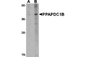 Western blot analysis of PPAPDC1B in EL4 cell lysate with PPAPDC1B antibody at (A) 1 and (B) 2 µg/mL. (PPAPDC1B 抗体  (N-Term))
