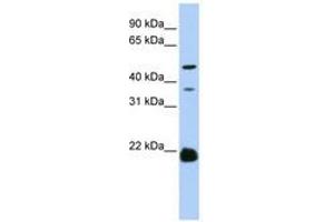 Image no. 1 for anti-Zinc Finger, DHHC-Type Containing 14 (ZDHHC14) (AA 108-157) antibody (ABIN6740780) (ZDHHC14 抗体  (AA 108-157))