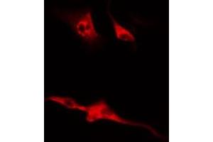 Immunofluorescence (fixed cells) (IF/ICC) image for anti-Cyclin B1 (CCNB1) (pSer126) antibody (ABIN6256122)