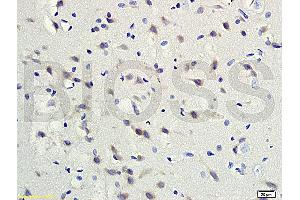 Formalin-fixed and paraffin embedded rat brain tissue labeled with Rabbit Anti-gremlin Polyclonal Antibody (ABIN687082) at 1:200 followed by conjugation to the secondary antibody and DAB staining. (GREM1 抗体  (AA 101-184))