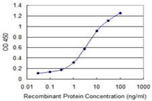 Detection limit for recombinant GST tagged DAPK2 is 0. (DAPK2 抗体  (AA 281-370))