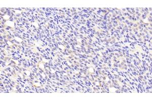 Detection of PEDF in Mouse Kidney Tissue using Polyclonal Antibody to Pigment Epithelium Derived Factor (PEDF) (PEDF 抗体  (AA 19-417))