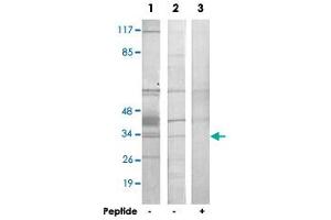 Western blot analysis of extracts from HepG2 cells (Lane 1 and lane 3) and COLO 205 cells (Lane 2), using HNRNPC polyclonal antibody . (HNRNPC 抗体)