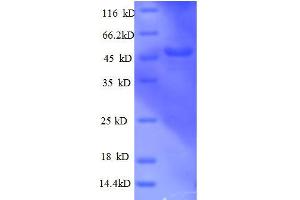 SDS-PAGE (SDS) image for Actin Related Protein 2/3 Complex, Subunit 3, 21kDa (ARPC3) (AA 2-175), (partial) protein (GST tag) (ABIN7479306)