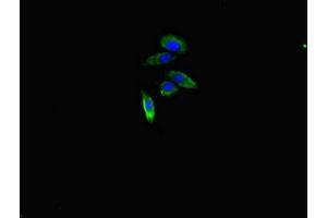 Immunofluorescent analysis of HepG2 cells using ABIN7167919 at dilution of 1:100 and Alexa Fluor 488-congugated AffiniPure Goat Anti-Rabbit IgG(H+L) (ARHGAP1 抗体  (AA 542-744))