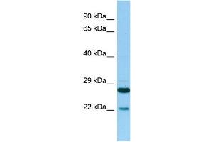 WB Suggested Anti-PTGES2 Antibody Titration: 1. (PTGES2 抗体  (N-Term))