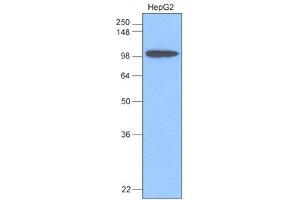 Western Blotting (WB) image for anti-Hexokinase 1 (HK1) antibody (ABIN361062) (Hexokinase 1 抗体)