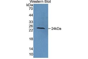 Western blot analysis of the recombinant protein. (PTPRA 抗体  (AA 618-796))