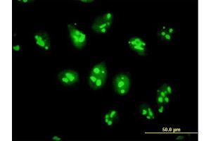 Immunofluorescence of purified MaxPab antibody to PES1 on HeLa cell. (PES1 抗体  (AA 1-588))