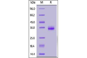 SDS-PAGE (SDS) image for SARS-CoV-2 Spike S1 (B.1.351 - beta), (RBD) (Active) protein (His tag) (ABIN7013274)