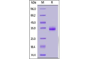 SARS-CoV-2 S protein RBD (K417N, E484K, N501Y), His Tag on  under reducing (R) condition. (SARS-CoV-2 Spike S1 Protein (B.1.351 - beta, RBD) (His tag))