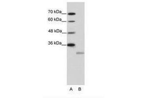 Image no. 1 for anti-Eukaryotic Translation Initiation Factor 4E Family Member 2 (EIF4E2) (N-Term) antibody (ABIN202116) (EIF4E2 抗体  (N-Term))