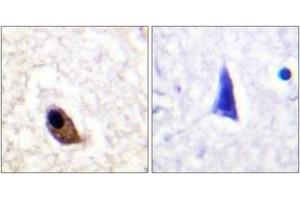 Immunohistochemistry analysis of paraffin-embedded human brain, using NMDAR2A/B (Phospho-Tyr1246/1252) Antibody. (NMDAR2A + 2B 抗体  (pTyr1246))