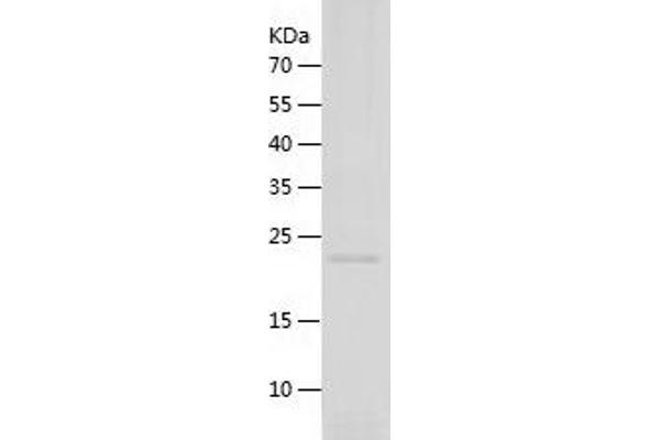 Thrombopoietin Protein (THPO) (AA 23-195) (His tag)