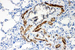 Anti- ATP2A2 antibody,IHC(P) IHC(P): Rat Lung Tissue (ATP2A2 抗体  (N-Term))