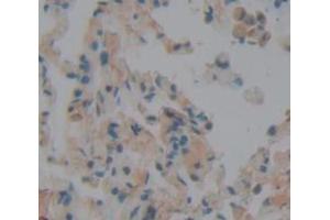 IHC-P analysis of Human Tissue, with DAB staining. (Peroxidasin 抗体  (AA 76-260))