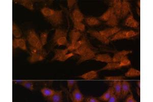 Immunofluorescence analysis of C6 cells using DDX3X Polyclonal Antibody at dilution of 1:100. (DDX3X 抗体)