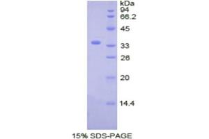 SDS-PAGE analysis of Human CDK4 Protein. (CDK4 蛋白)