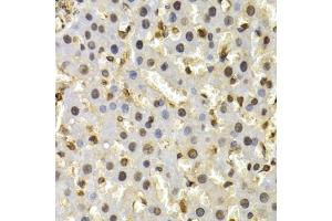 Immunohistochemistry of paraffin-embedded rat liver using CUL4B antibody (ABIN6130211, ABIN6139255, ABIN6139258 and ABIN6221048) at dilution of 1:200 (40x lens).