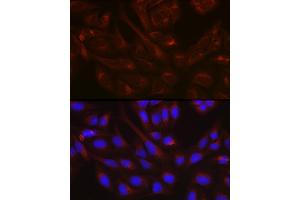 Immunofluorescence analysis of U-2 OS cells using NSF Rabbit pAb (ABIN6130571, ABIN6144871, ABIN6144872 and ABIN6214029) at dilution of 1:100 (40x lens). (NSF 抗体  (AA 1-250))