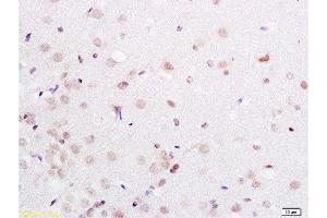 Immunohistochemistry (Paraffin-embedded Sections) (IHC (p)) image for anti-Paired Box 3 (PAX3) (AA 151-250) antibody (ABIN737616)