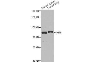 Western blot analysis of extracts of various cell lines, using IFI16 antibody. (IFI16 抗体)