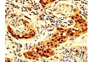 Immunohistochemistry (IHC) image for anti-Sodium Channel, Nonvoltage-Gated 1, beta (SCNN1B) (AA 554-640) antibody (ABIN7143973)