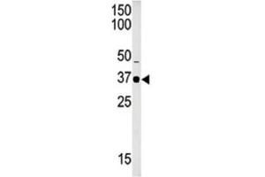 Western Blotting (WB) image for anti-SET Domain Containing 8 Pseudogene 1 (SETD8P1) antibody (ABIN2996452) (SET7 抗体)