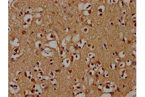Immunohistochemistry (IHC) image for anti-Proteasome (Prosome, Macropain) 26S Subunit, Non-ATPase, 4 (Psmd4) (AA 161-377), (Regulatory Subunit 4) antibody (ABIN7142212)