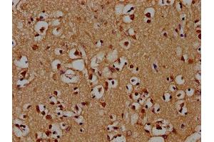 IHC image of ABIN7142212 diluted at 1:100 and staining in paraffin-embedded human brain tissue performed on a Leica BondTM system. (PSMD4/ASF 抗体  (Regulatory Subunit 4))