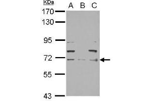 WB Image Sample (30 ug of whole cell lysate) A: PC-3 B: U87-MG C: SK-N-SH 7. (NEFL 抗体)