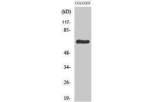 Western Blotting (WB) image for anti-Ribosomal Protein S6 Kinase, 70kDa, Polypeptide 1 (RPS6KB1) (Internal Region) antibody (ABIN6282427)