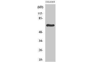 Western Blotting (WB) image for anti-Ribosomal Protein S6 Kinase, 70kDa, Polypeptide 1 (RPS6KB1) (Internal Region) antibody (ABIN3186301) (RPS6KB1 抗体  (Internal Region))
