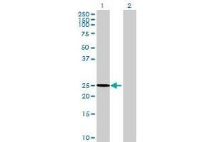 Lane 1: GSTA3 transfected lysate ( 24. (GSTA3 293T Cell Transient Overexpression Lysate(Denatured))