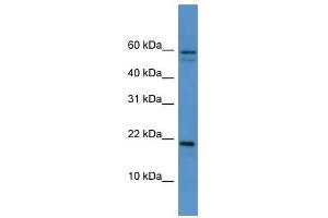 Hspb7 antibody used at 0. (HSPB7 抗体  (Middle Region))