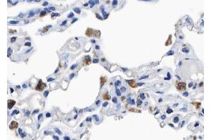 ABIN6267559 at 1/100 staining human lung tissue sections by IHC-P. (BCAR1 抗体  (pTyr410))